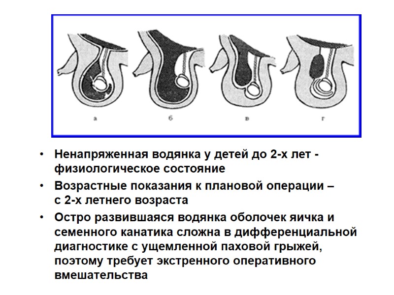 Ненапряженная водянка у детей до 2-х лет -  физиологическое состояние  Возрастные показания